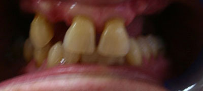 Before