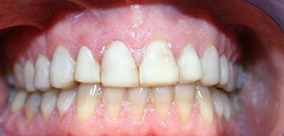 Before