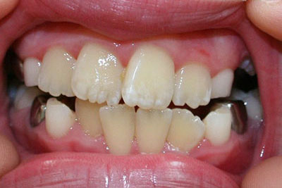 Before